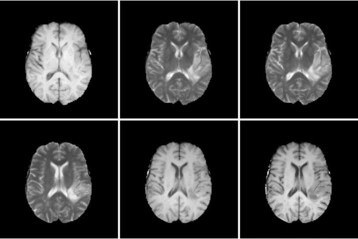 Brain MRI slices: input, ground truth and CMCD output for T1 to T2 (top) and T2 to T1 (bottom).